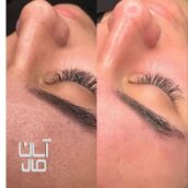 پاکسازی(فیشیال)تخصصی پوست