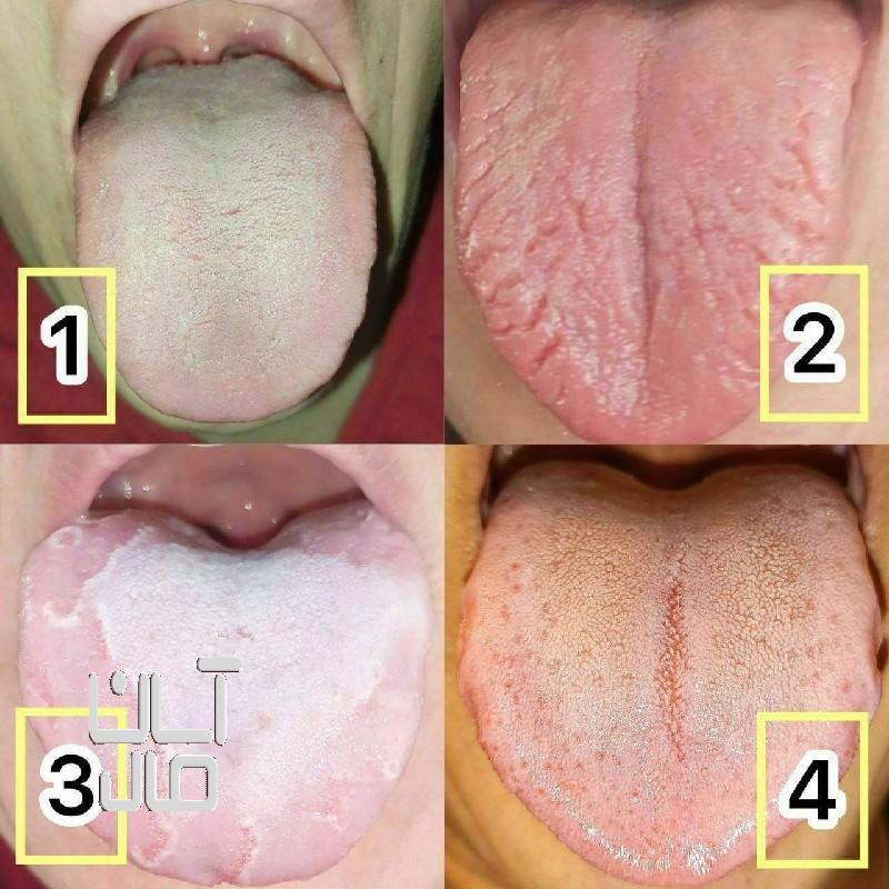 پاکسازی به روش طب سنتی