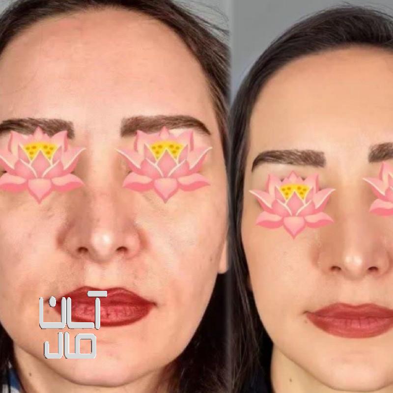 محصولات آرایشی و بهداشتی گیاهی