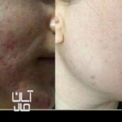 فرمول کرم وی ای پی