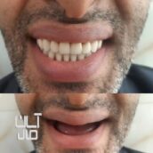 دندانسازی/دندان مصنوعی