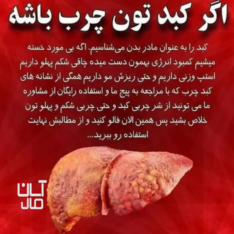 کبد چرب